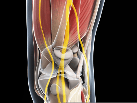 VOKA 3D Anatomi og patologi