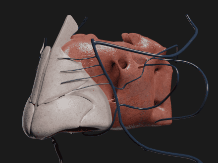 Interaktiv anatomisk 3D-modell støttet av en trykt prototype for en produsent av medisinsk utstyr