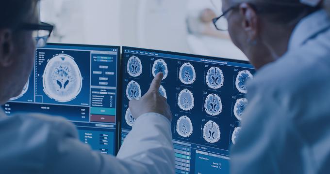 Healthcare professionals reviewing neurological MRI results on a multi-screen setup